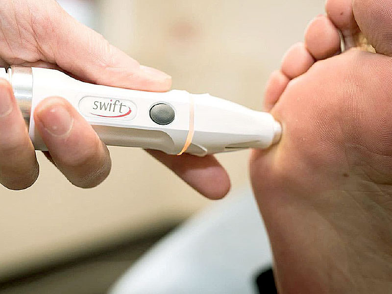 Podiatrist and Chiropodist, Maldon Blackwater Podiatry Podiatrist and Chiropodist, Maldon Blackwater Podiatry